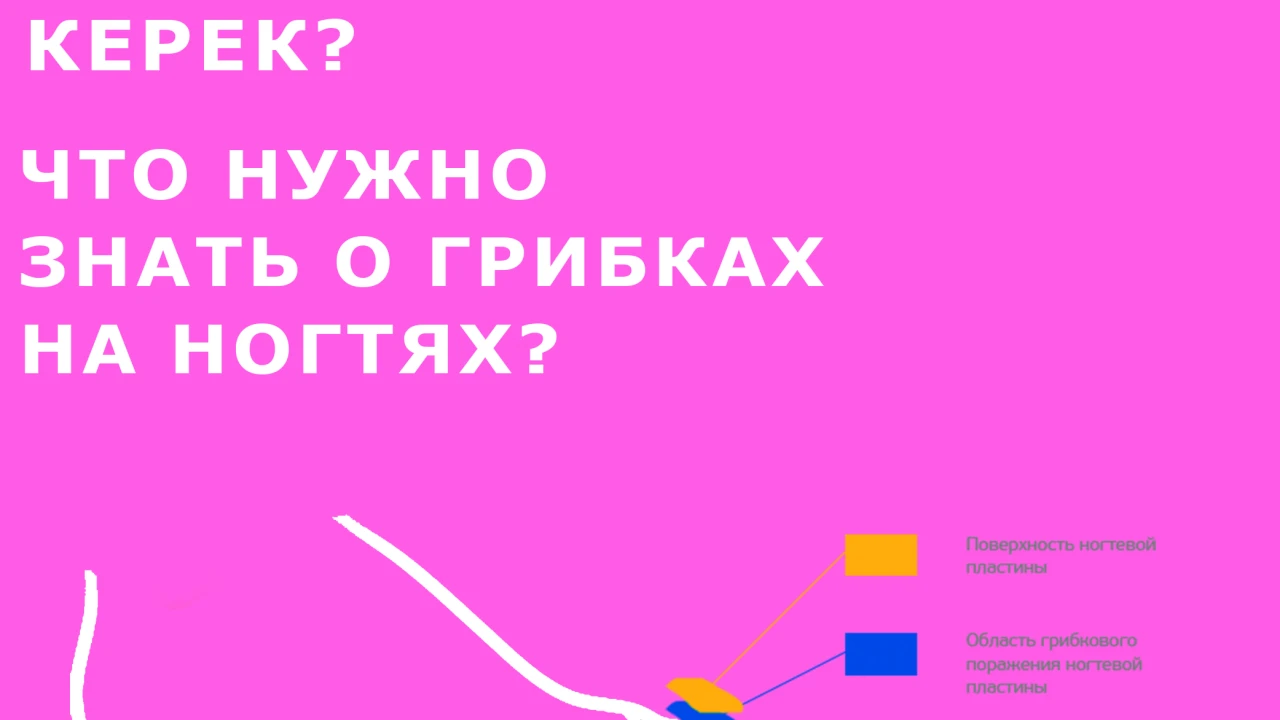 Что нужно знать о грибках на ногтях? 